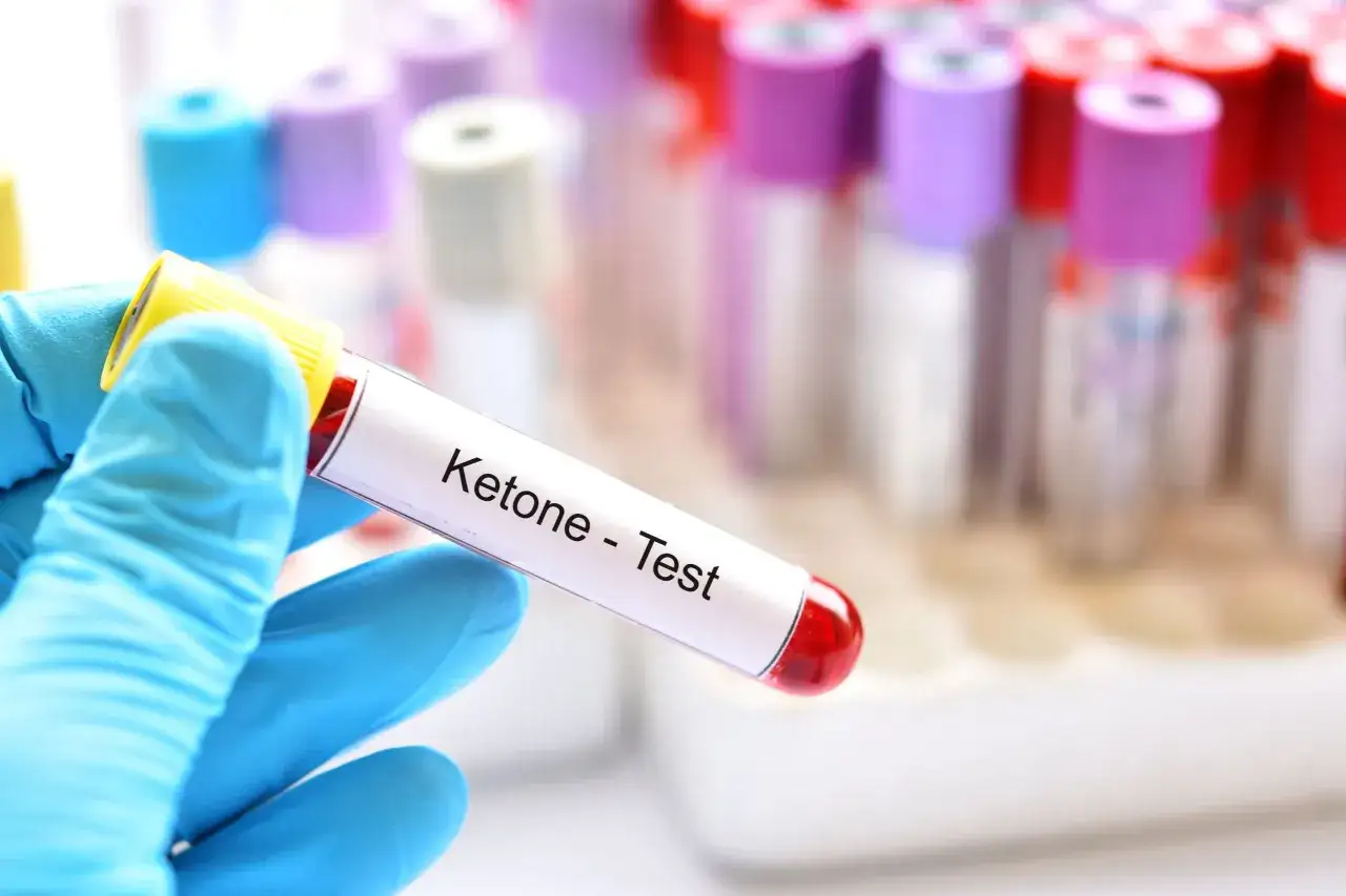 Ręka w niebieskiej rękawiczce trzyma probówkę z krwią do testu ketonowego. To badanie pomaga wykryć kwasicę ketonową objawy.