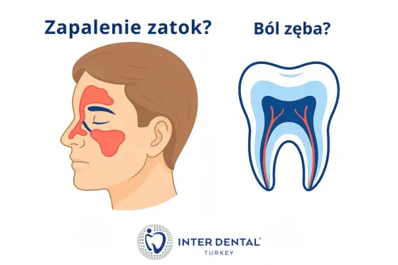 Ból zęba przy dotyku - co oznacza i kiedy iść do dentysty?