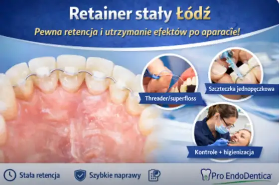 Aparat stały - koszty, rodzaje, higiena i retencja
