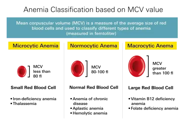 Porównanie wielkości krwinek czerwonych w mikrocytozie, normocytozie i makrocytozie. Badania na anemię oceniają te parametry.
