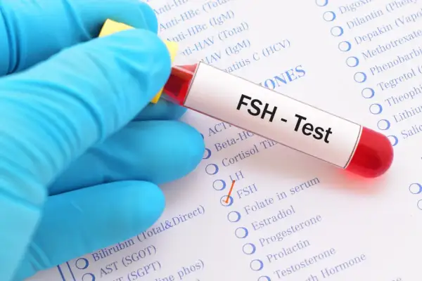 Rękawiczka w niebieskiej rękawiczce trzyma probówkę z napisem "FSH - Test". Obok zaznaczono opcję FSH na liście badań.