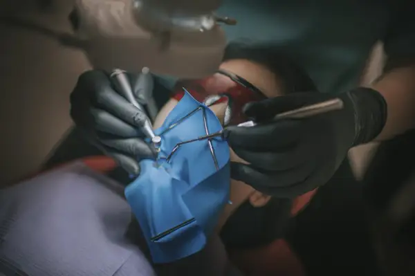 Precyzyjne leczenie kanałowe pod mikroskopem. Dentysta w rękawiczkach używa narzędzi do zabiegu.
