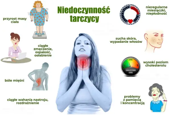 Objawy niedoczynności tarczycy: przyrost masy ciała, zmęczenie, bóle mięśni, wahania nastroju, sucha skóra, wypadanie włosów, problemy z pamięcią.