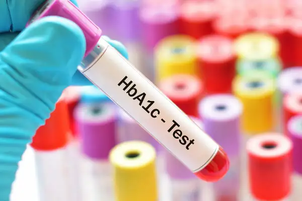 Rękawiczka trzyma probówkę z oznaczeniem HbA1c - Test. Tło to wiele kolorowych probówek. Sprawdź, jaka jest hemoglobina glikowana cena.